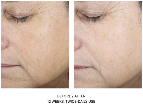 SkinBetter Science Even Intensive Skin Tone Correcting Serum 50mL - Image 5